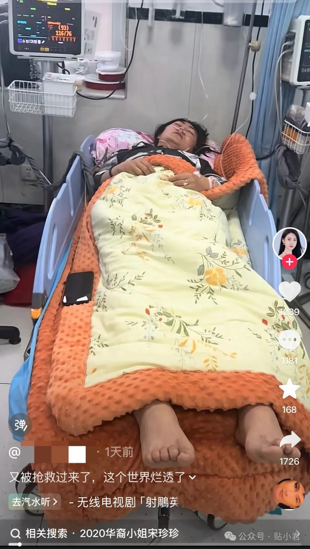 史上最貴的吻,540億沒了