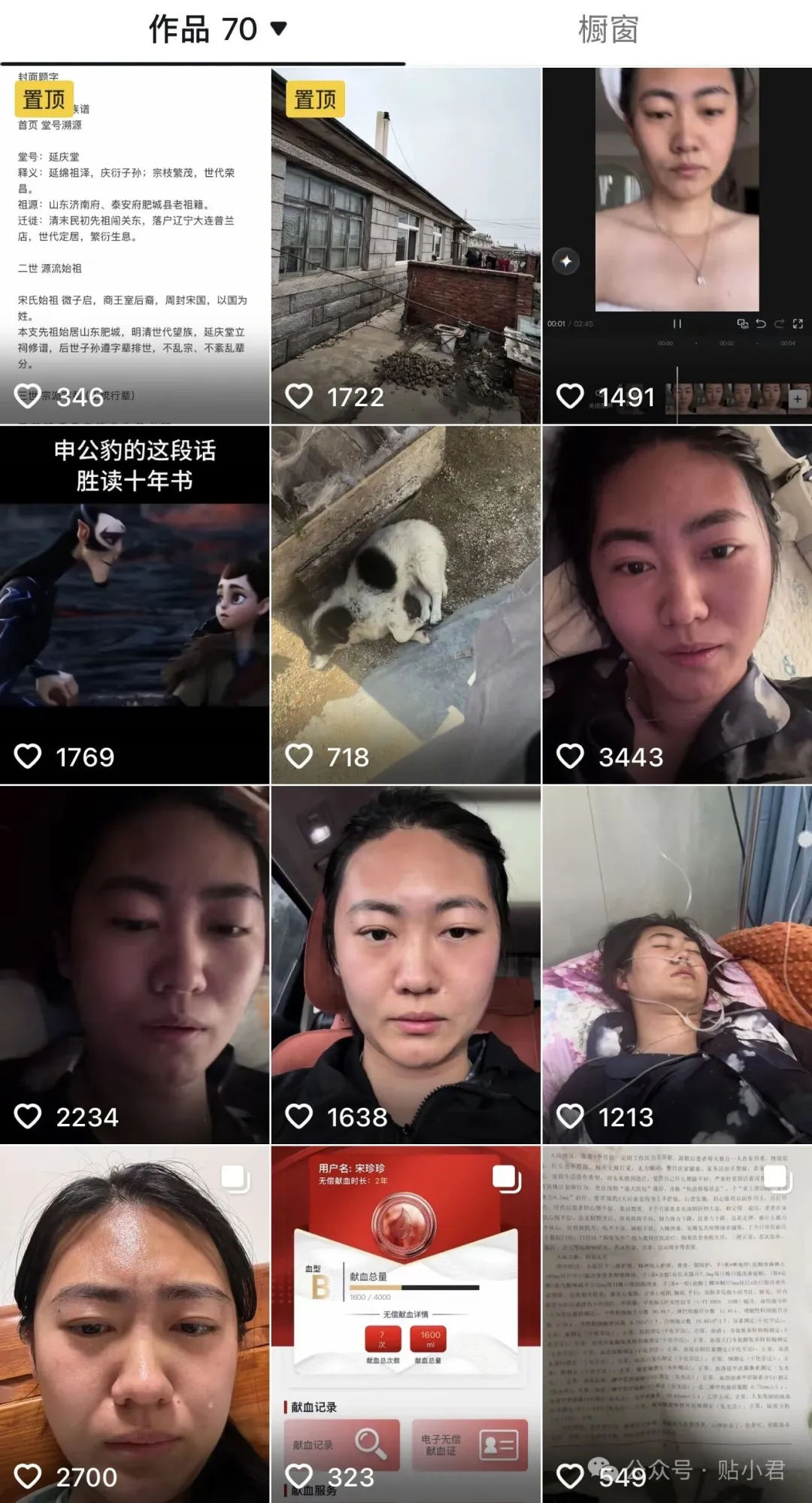 史上最貴的吻,540億沒了
